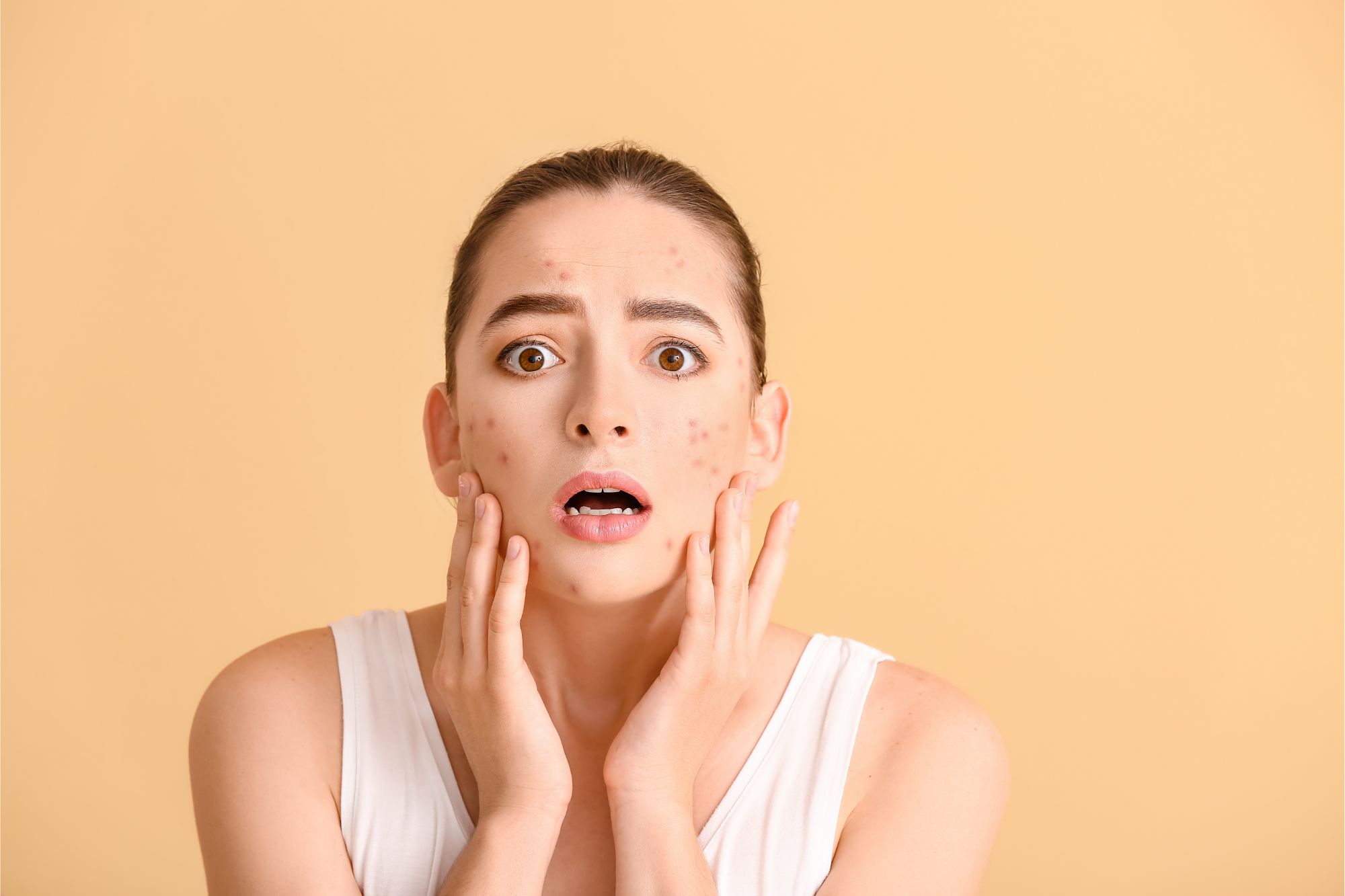 Acne Laser Treatment: Effectiveness, Price & Results Breakdown